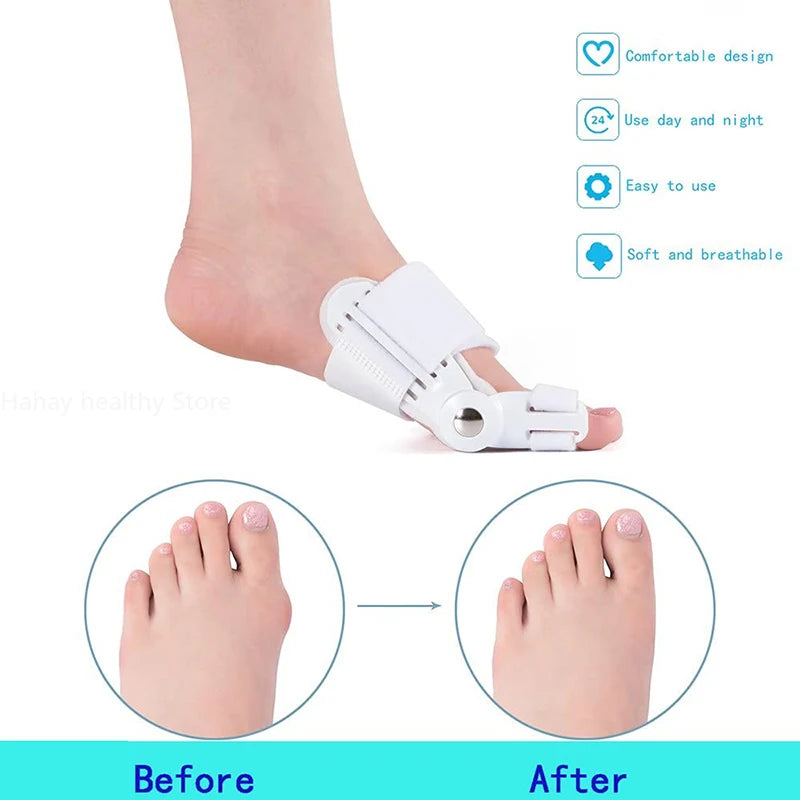 Bunion Corrector Device