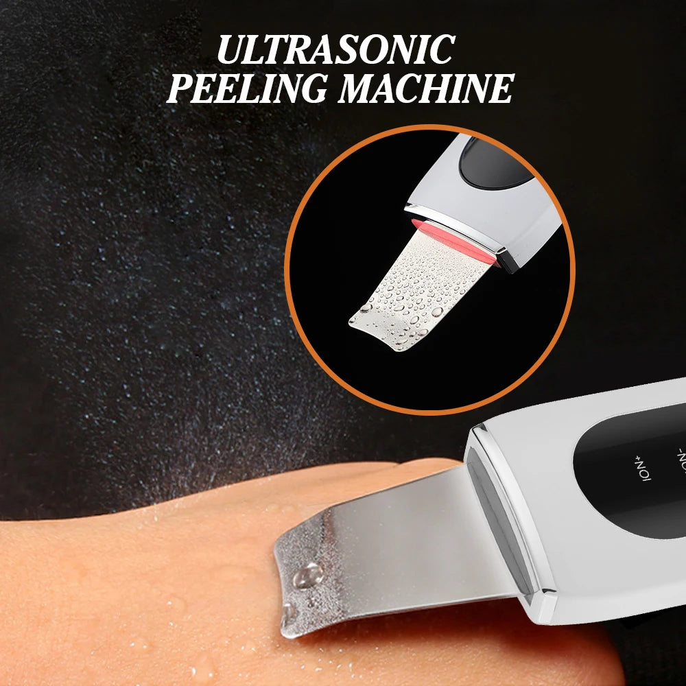 Ultrasonic Exfoliator