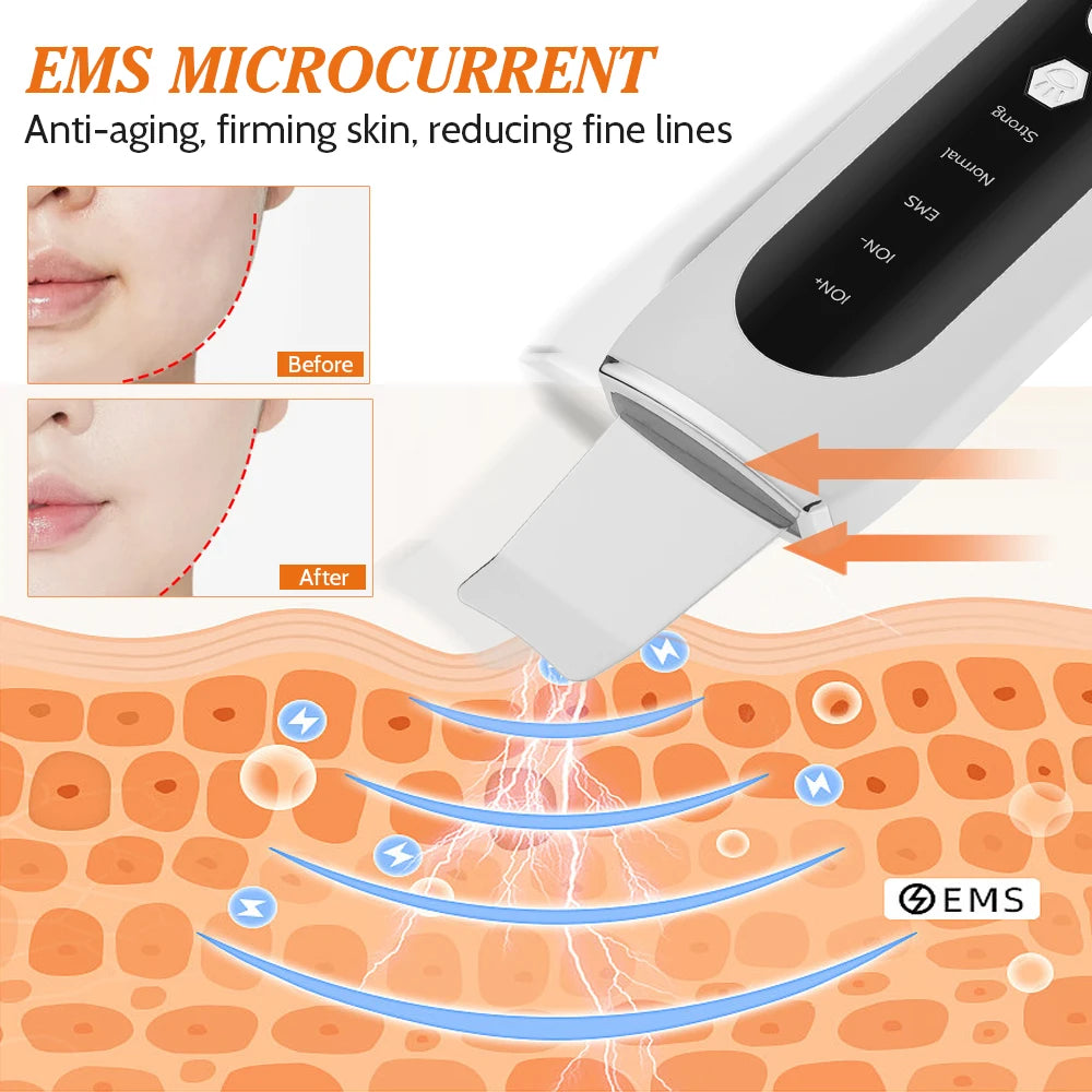 Ultrasonic Exfoliator